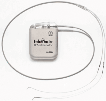 Image: The EndoStim system IPG and bipolar lead (Photo courtesy of EndoStim).